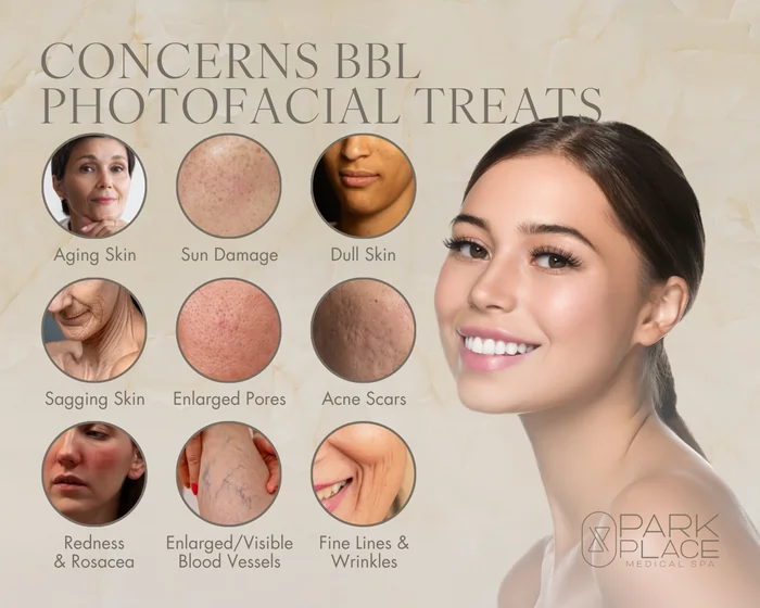 Graphic showing skin concerns treated by BBL Photofacial, including aging skin, sun damage, dull skin, sagging skin, enlarged pores, acne scars, redness and rosacea, visible blood vessels, and fine lines and wrinkles, Park Place Medical Spa.