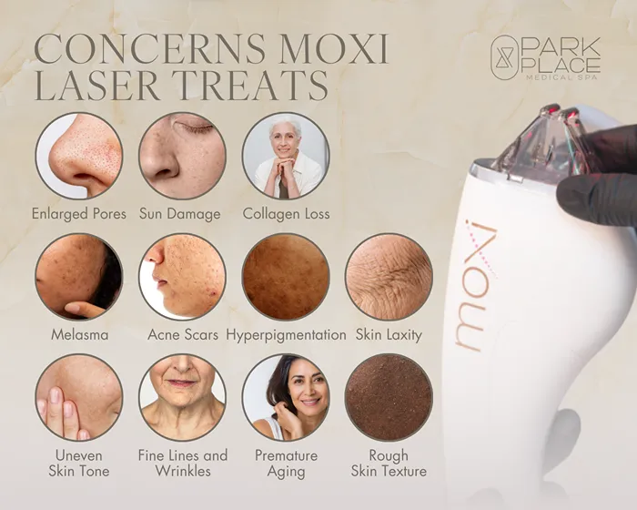 Concerns Moxi treats